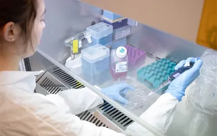 Uveal melanoma: a step forward to improve patient monitoring using circulating biomarkers