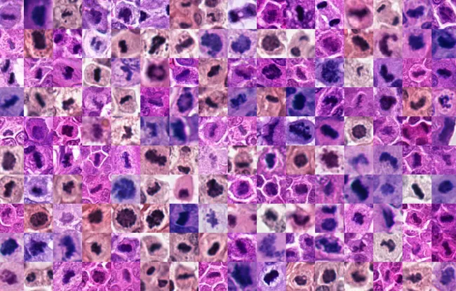 IA : l’équipe du Pr Thomas Walter se distingue au challenge international MIDOG 2025 sur la détection des mitoses