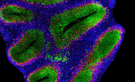 GIF composé de differentes images montrant des organoides et du tissus fetal immuno-marqué