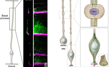 (Left) Live imaging of CAMSAP3-GFP and EB3-mCherry in mouse aRG cell basal process, and corresponding kymograph. (Right) The microtubule network of the apical process of aRG cells is unipolar, with the minus ends concentrated apically, and the plus ends growing in the basal direction. The mother centriole serves as a template for the primary cilium, which extends into the ventricle. A second ring-like microtubule network is present at the apical endfoot (PMID: 32238932). In the basal process of both aRG and
