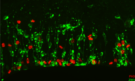 cellules souches neurales infectees par le virus ZIKA